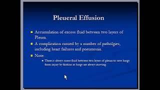 Chest Xray : Pleural effusion ( by hammadshams)