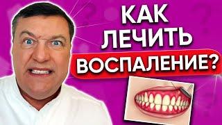 Как лечить СТОМАТИТ в домашних условиях? ВОСПАЛЕНИЕ во рту.