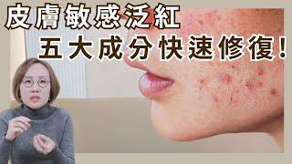皮膚泛紅、敏感肌，如何快速舒緩及修復？皮膚科告訴你，五大修復成分！