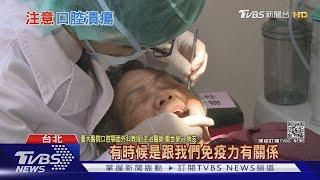 經常性"口腔潰瘍" 恐罹癌 醫師:輕忽這件事...終身遺憾｜十點不一樣 20210302