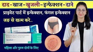 दाद खाज खुजली की दवा ||  Dermiford Cream uses , doses and side effects