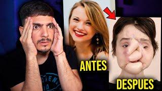 7 PERSONAS que PERDIERON el ROSTRO