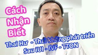 #325. Cách nhận biết thai hư không phát triển sau IUI - IVF - TTON | Hỏi Bác Sỹ Sinh Sản