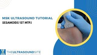 MSK ultrasound evaluation of the Sesamoid bones of the big toe of the foot.