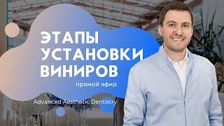 Этапы установки виниров