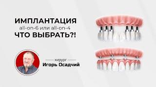 Имплантация Все-на-4 и Все-на-6, что выбрать?