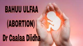 BAHUU ULFAA(ABORTION) Dr Caalaa Diidha