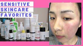 烂脸？晒伤？过敏毁容？如何护理敏感肌肤|Sensitive Skin Care Routine& Favorites