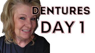 First Day with Immediate Dentures /  Full mouth extraction with immediate dentures