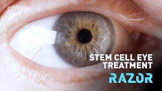 Stem cell eye treatment #RAZOR