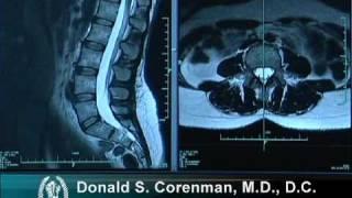 How to Read a MRI of the Normal Lumbar Spine | Lower-Back | Vail Spine Specialist