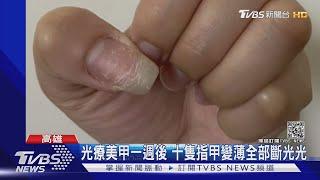 光療美甲一週後 十隻指甲變薄全部斷光光｜TVBS新聞