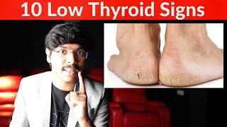 10 Skin Signs of LOW THYROID (Skin Signs of Hypothyroidism) in Telugu! మీ SKIN చెప్పేస్తుంది