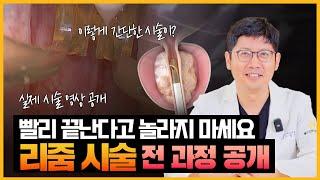 수증기를 이용해 전립선 비대증을 치료하는 리줌 시술, 실제 시술 영상과 함께 설명해드립니다!