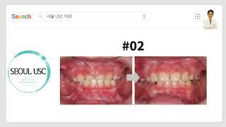 평택 교정전문 치과 서울 USC 치과란 ~?