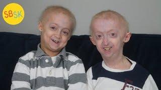 Brothers with the Same Rare Condition (Growing up with Progeria)