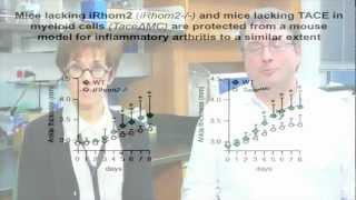 iRHOM2 is a critical pathogenic mediator of inflammatory arthritis