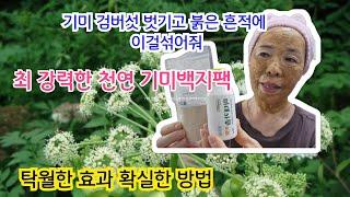 여름철 강력한 기미제거 팩/백지가루로 기미없애고 붉은흔적은 이게 최고지 탁월한효과 확실한방법