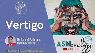 Vertigo by Dr Gamini Pathirana