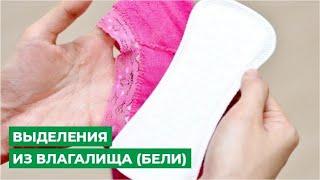 Выделения из влагалища (бели)