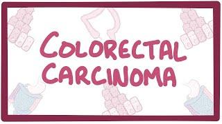 Colorectal carcinoma - causes, symptoms, diagnosis, treatment, pathology