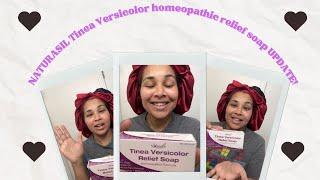 NATURASIL tinea versicolor RELIEF soap UPDATE!!