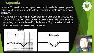 Isquemia en electrocardiograma