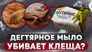  Дегтярное мыло против клеща? | Угревая Железница Demodex