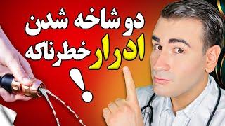 علت دو شاخه شدن ادرار، فشار کم ادرار و دفع ناقص ادرار! از عادی تا خطرناکترین! | Split Urine Stream