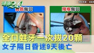 全口蛀牙一次拔20顆 女子隔日昏迷9天後亡 健康2.0