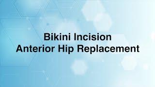 Bikini Incision Anterior Approach for Total Hip Replacement