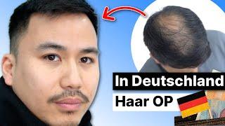 Meine Haartransplantation in Deutschland | Erfahrung nach 7 Monaten