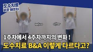 ️제일정형외과 도수치료 Before & After #01