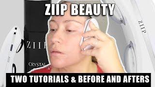 ZIIP BEAUTY REVIEW | TWO TUTORIALS WITH BEFORE AND AFTERS