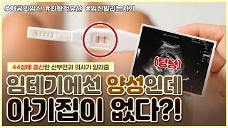 임신 확인 방법 총정리｜착상 실패? 자궁외임신? ｜임밍아웃 시기 추천해드립니다! - [노노산부인과 ep40]