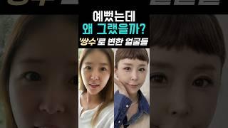 쌍수 전이 예쁜 연예인 얼굴 특징