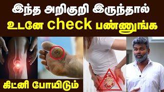 Health care: கிட்னி Failure-ஐ சுலபமா சரி செய்யலாம் | Kidney Transplant details | symptoms