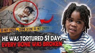 This Case Is So Gruesome Most People Can't Finish It! Incredible Injuries, Like After a Tornado!