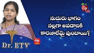 What Are The Causes Of Black Forehead? | Dr.ETV | 19th Dec 2022  | ETV Life