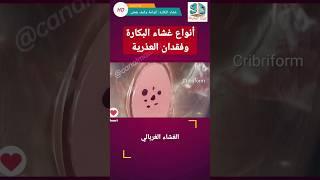 أنواع غشاء البكارة وكيف تفقد العذرية.
