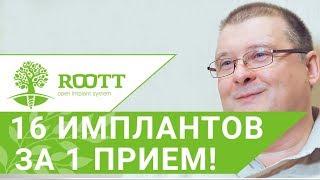  16 имплантов за 1 прием - Отзыв пациента об имплантации зубов в клинике ROOTT