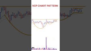 VCP Chart Pattern | Swing trade Strategy | #shorts