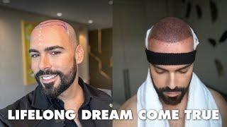 My Emotional Hair Transplant Journey in Istanbul, Turkey with Hairneva