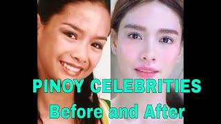 PINOY CELEBRITY (BEFORE AND AFTER)