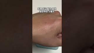 색소침착 없애는법 (여드름 흔적 치트템) #shorts