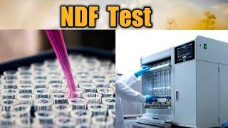 NDF Test | Feed Mill Lab Test | @Dr.Abu-BakarNaeem