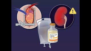 Amino Acid Infusion and Kidney Protection | NEJM