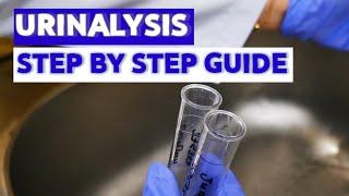 HOW TO DO URINALYSIS?| |MEDICAL LABORATORY SCIENCE