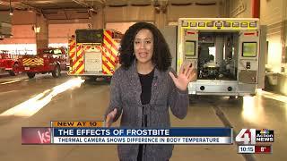 Overland Park Fire Department shares its winter safety tips