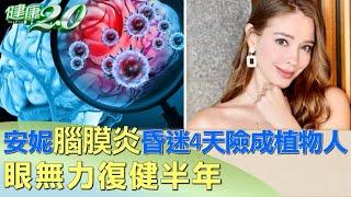 安妮腦膜炎昏迷4天險成植物人 眼無力復健半年 健康2.0